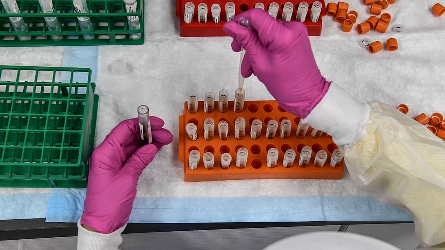 A lab technician sorts blood samples for Covid-19 vaccination study. Credit: AFP Photo