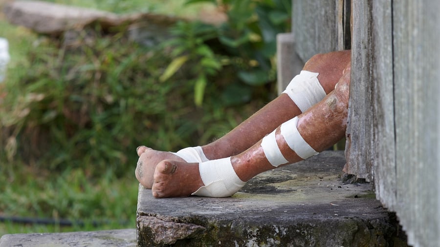 Representative Image. Credit: iStock Photo