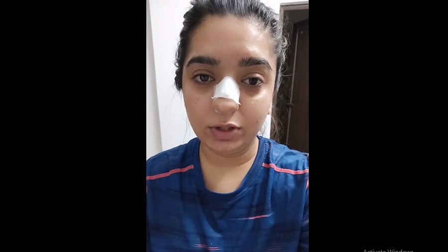 Hitesha Chandranee was allegedly assaulted by a Bengaluru Zomato delivery executive Kamaraj. Credit: Instagram/hiteshachandranee
