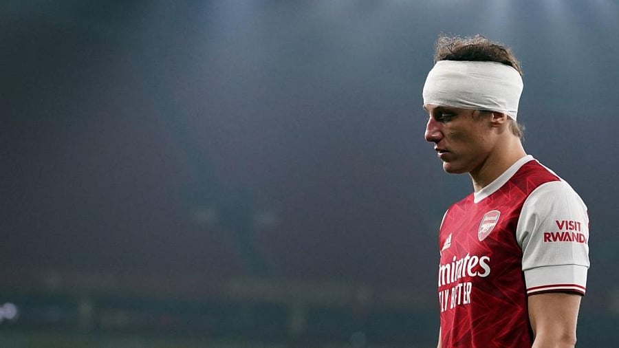 this file photo taken on November 29, 2020 Arsenal's Brazilian defender David Luiz is bandaged after clashing heads with Wolverhampton Wanderers' Mexican striker Raul Jimenez during the English Premier League football match between Arsenal and Wolverhampton Wanderers at the Emirates Stadium in London. Credit: AFP.