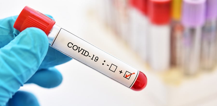 As of now, there are 5,972 active Covid-19 cases in the district. Credit: iStock Photo