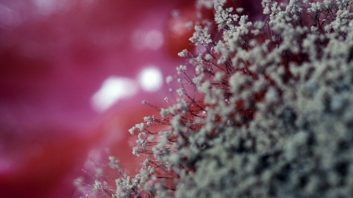 A number of cases of the fungal infection among Covid-19 patients have been reported in neighbouring Maharashtra and Gujarat. Representative image. Credit: iStock Photo