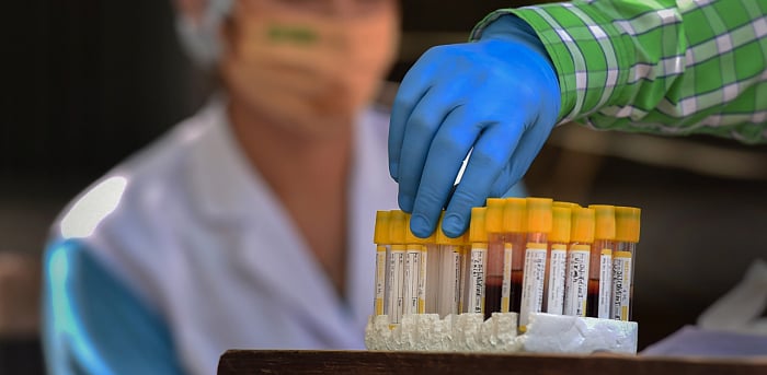 A health worker handles a vial containing blood sample of a person for serological survey. Credit: PTI Photo