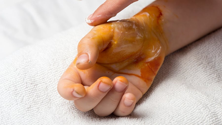 Representative Image. Credit: iStock Photo