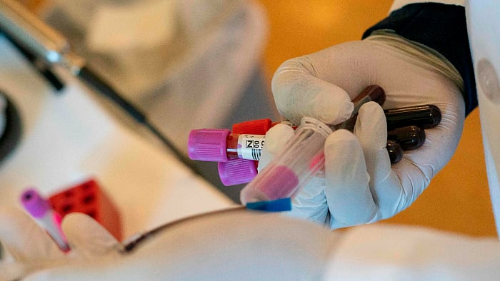 A total of 135 patients received 169 units of plasma during the two waves of Covid-19, and 113 of them recovered. Credit: AFP Photo