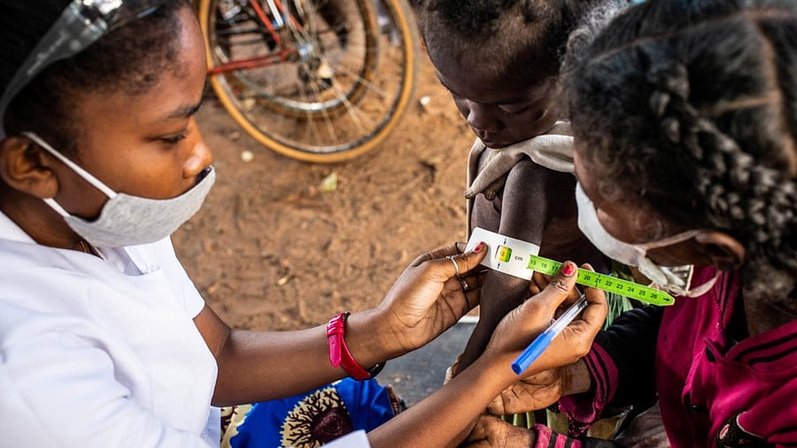 A child is screened for malnutrition on the upper arm circumference in a nutrition project in Etakaky, Ampanihy District, Madagascar. Credit: Reuters Photo