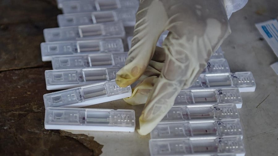 A BMC health worker oberves swab samples collected from passengers for COVID-19 test, at a station in Mumbai. Credit: PTI Photo