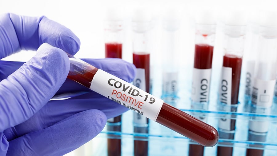 The new mutations/variants of concern are cultured and scientific studies are undertaken to see the impact on infectiousness, virulence, vaccine efficacy. Credit: iStock Photo