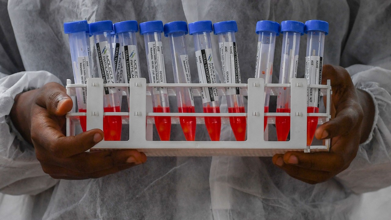 Representative image. Credit: AFP Photo