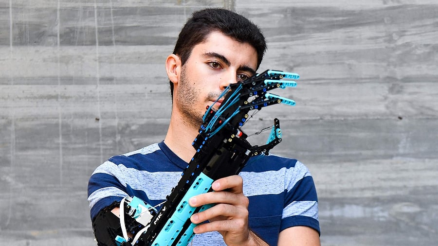 David Aguilar, 22, affected by Poland syndrome, poses with his self-built prosthetic arm, made with Lego pieces. Credit: AFP Photo