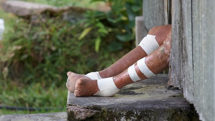 Representative Image. Credit: iStock Photo