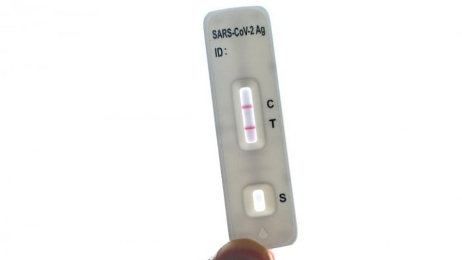 The growth of this segment comes at a time when the Covid portfolio for testing labs like SRL Diagnostics and Metropolis is gradually coming down. Credit: AFP File Photo