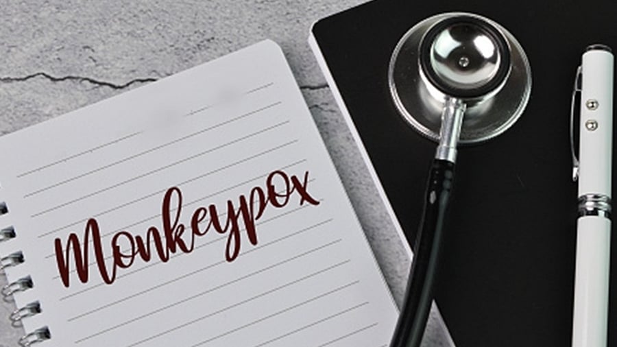 The virus is not as easily transmitted as the SARS-CoV-2 virus that spurred the global Covid-19 pandemic. Credit: IANS Photo