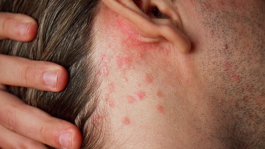 Representative image. Credit: iStock Photo