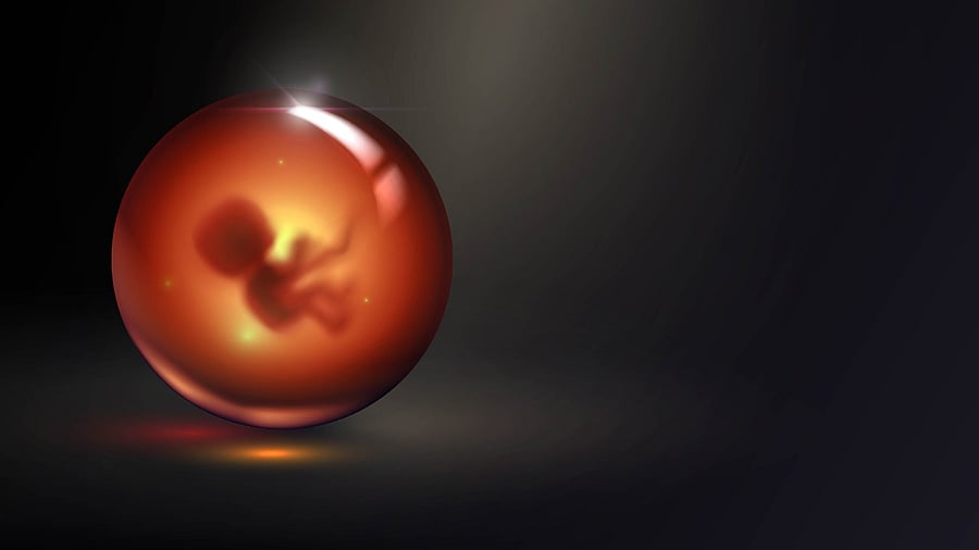 Credit: iStock image