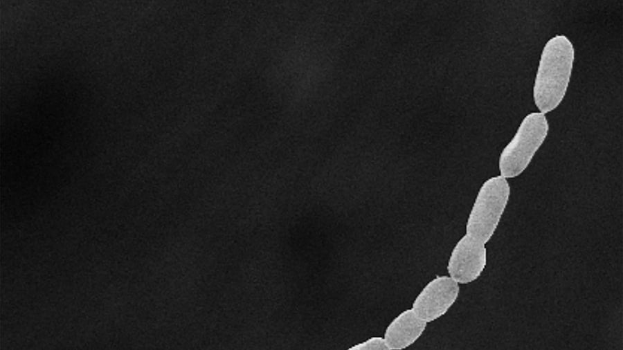This handout image released by Lawrence Berkeley National Laboratory on June 23, 2022, shows a 3D microscope image of giant bacteria Ca Thiomargarita magnifica. Credit: AFP Photo/Olivier Gros/Lawrence Berkeley National Laboratory
