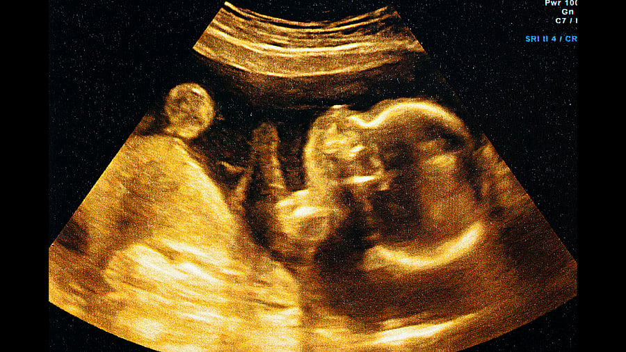 Representative image. Credit: iStock Photo