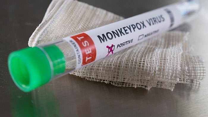 Illustration shows test tube labelled 'Monkeypox virus positive'. Credit: Reuters File Photo