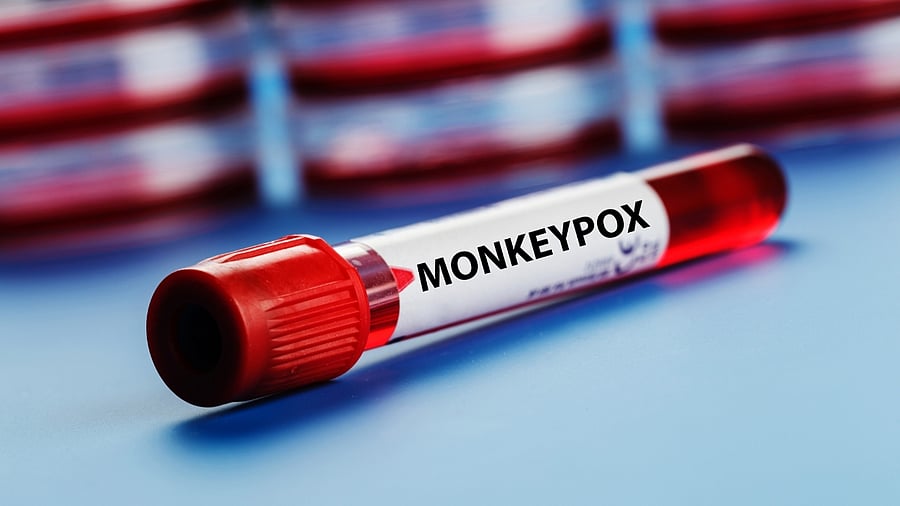 Representative image. Credit: IANS Photo