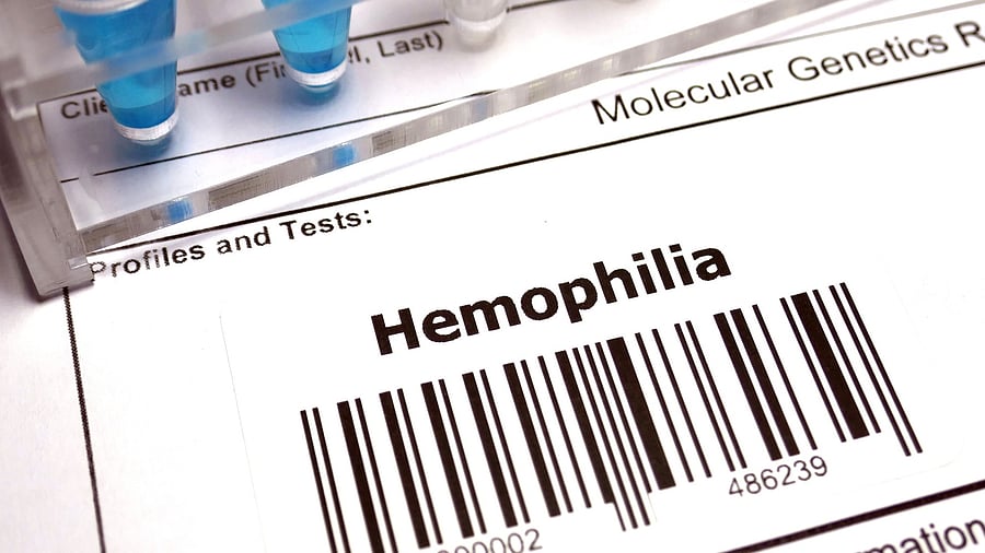 Haemophilia B is a rare and inherited genetic bleeding disorder caused by low levels of the factor IX (FIX) protein, needed for forming blood clots that help prevent or stop bleeding. Credit: iStock Photo