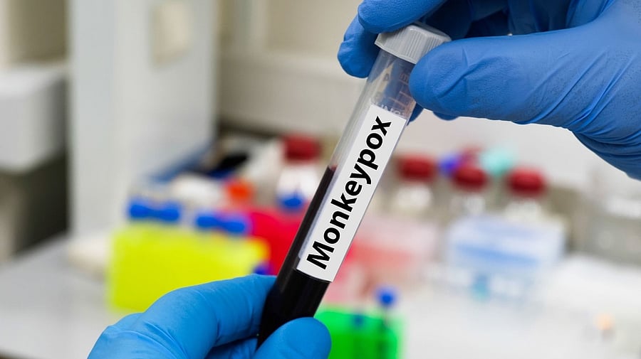 Representative image. Credit: IANS Photo