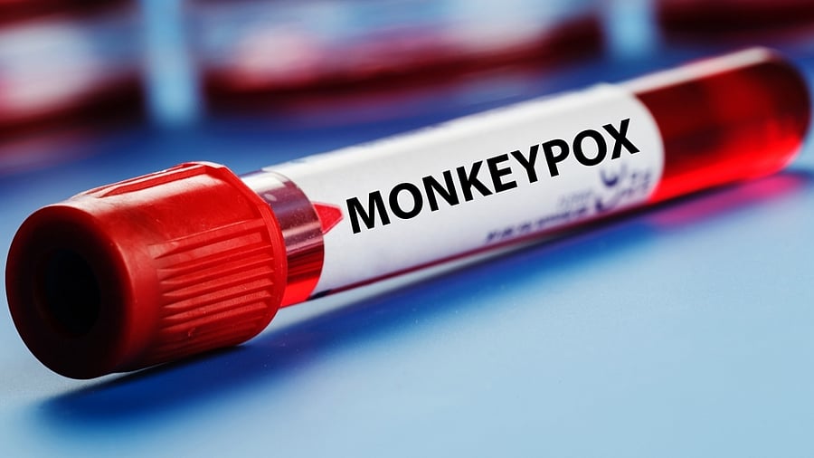 The announcement came as part of a circular issued by the civic body for surveillance and management of monkeypox within the BBMP limits. Credit: IANS Photo