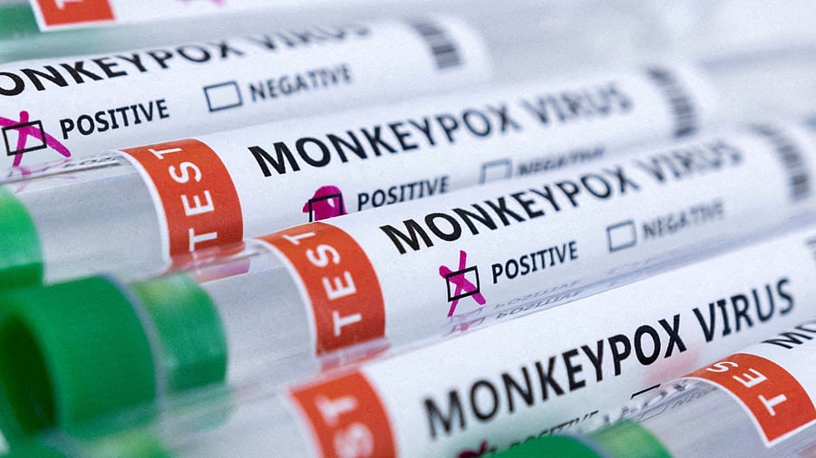 The kit would help in early detection and better management of the infection. Credit: Reuters Photo