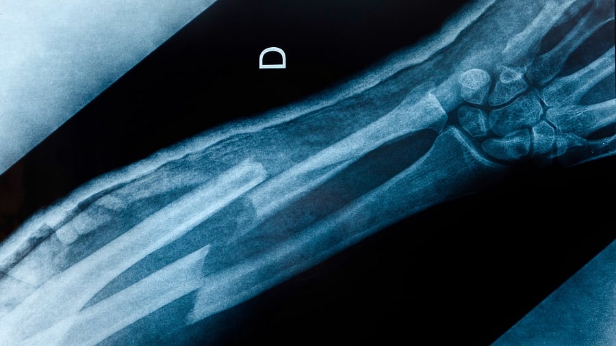 Representative image. Credit: iStock photo