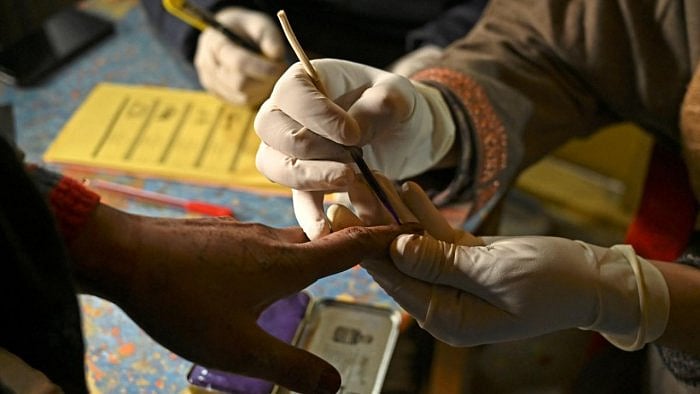 Representative image. Credit; AFP Photo