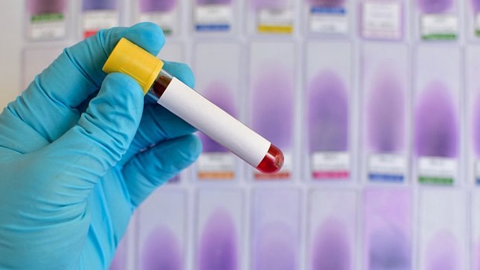 Representative Image. Credit: iStock Photo