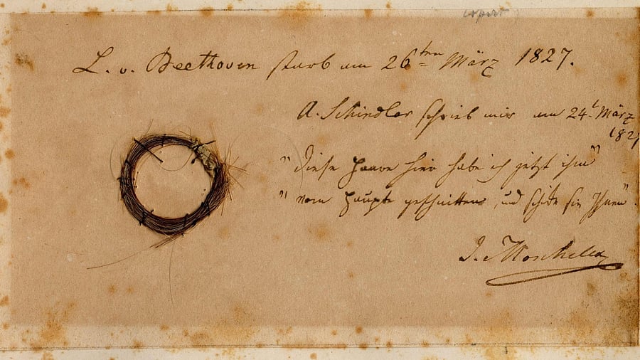  Beethoven's genome using locks of the German composer's hair may now have some answers. Credit: AFP Photo/ Ira F. Brilliant / Center for Beethoven Studies, San Jose State University