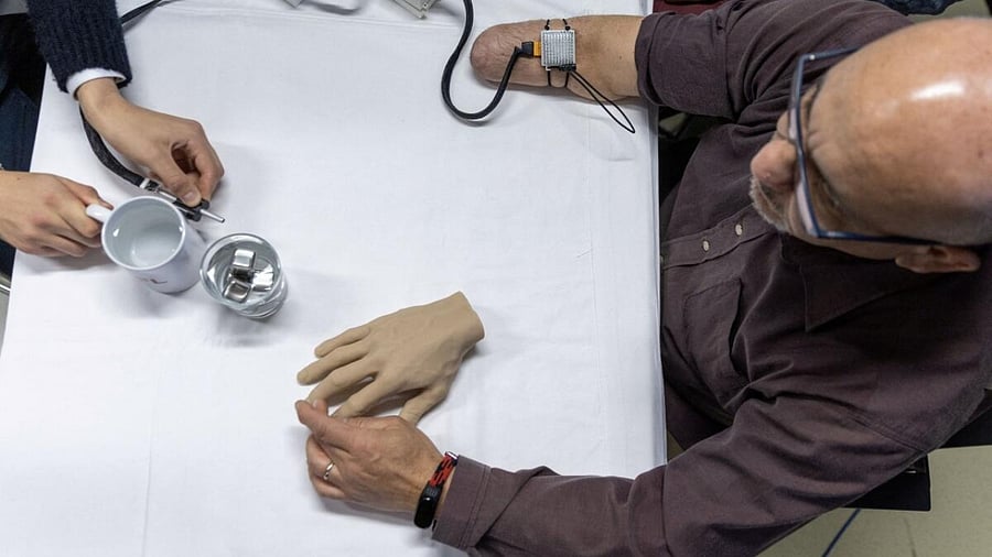Fabrizio Fidati, who lost his right hand in an accident 25 years ago, points on a rubber hand where he feels on his fantom hand the sensor that Jonathan Muheim doctoral assistant applies on his limb during the presentation of bionic technology that helps amputees feel the temperature of objects again in their phantom hands at the Campus Biotech at the Swiss Federal Institute of Technology (EPFL) in Geneva, Switzerland April 19, 2023. Credit: Reuters Photo