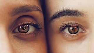 World Sight Day: 6 Signs Your Eyes Are Asking for Attention