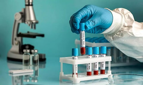 പ്രതിദിന കേസുകളില്‍ കുറവ്:  സംസ്ഥാനത്ത് പുതുതായി 13,984 കോവിഡ് ബാധിതര്‍