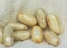 Jovem detido no Hospital de Portimão. Tinha droga introduzida no corpo e chegou a correr risco de vida