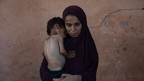 Mais de 7000 crianças com menos de cinco anos em Gaza recuperam de subnutrição em duas semanas