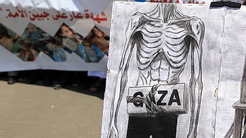 Um quarto das crianças em Gaza está subnutrida