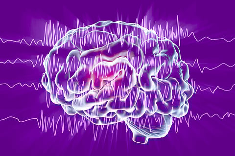 Pessoas com epilepsia são o dobro do estimado e quase metade sem seguimento médico