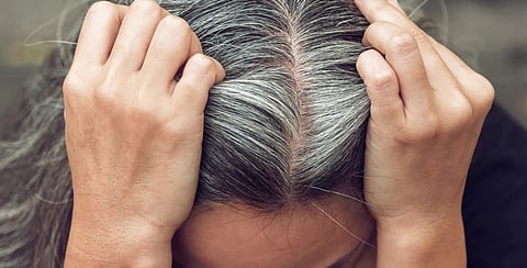 Estudo sugere que cabelos brancos e melanoma não são fenómenos separados, mas sim dois resultados diferentes de como as células reagem ao stress genético.