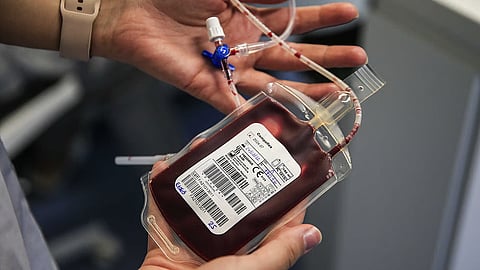 Federação de dadores volta a apelar à doação de sangue face à diminuição de reservas