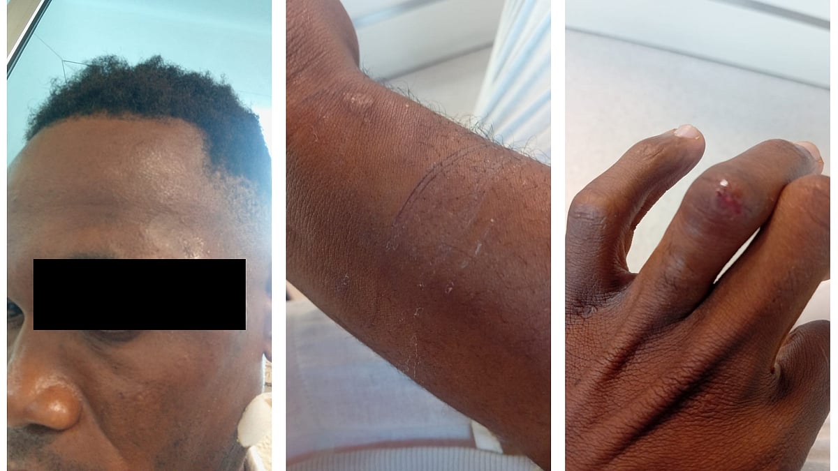 Young person from São Tomé stopped at airport says they were assaulted; PSP says there was resistance and force used was proportionate