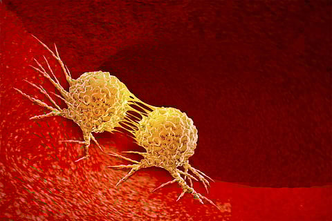 OMS alerta que quatro em cada 10 cancros devem-se a fatores de risco e podem ser evitáveis