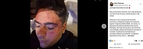 Foto após a agressão.