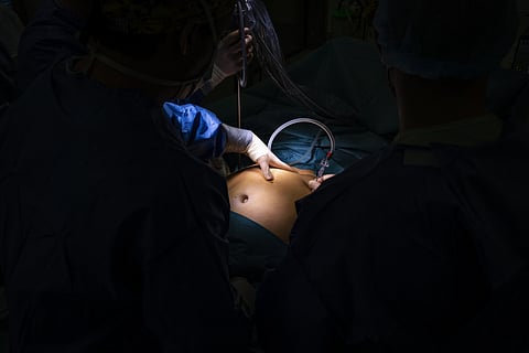Cirurgias à obesidade reduziram em relação a 2022. Mas o aumento em relação a 2021  é considerável: mais 391.