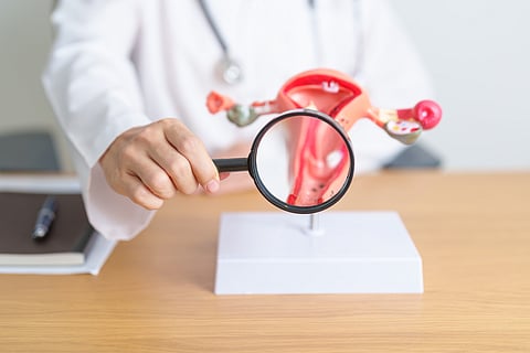 Cancro do endométrio: ser proativa faz a diferença