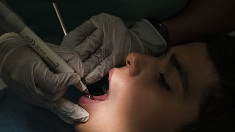 Periodontite afeta metade dos adultos após os 30 anos: especialistas alertam para riscos além da saúde oral