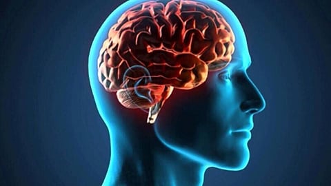 Pessoas com duas cópias de um gene de risco têm Alzheimer genético, dizem investigadores
