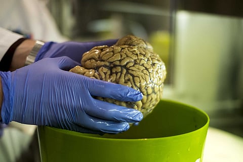 Estudo revela que o cérebro humano está a ficar maior