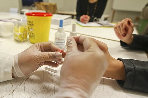 Seis pessoas testam positivo para HIV devido a transplantes de órgãos infectados no Brasil