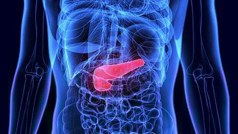 Incidência do cancro do pâncreas cresce mas investigação já permite curas iniciais 
